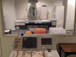 X線透視撮影装置の画像